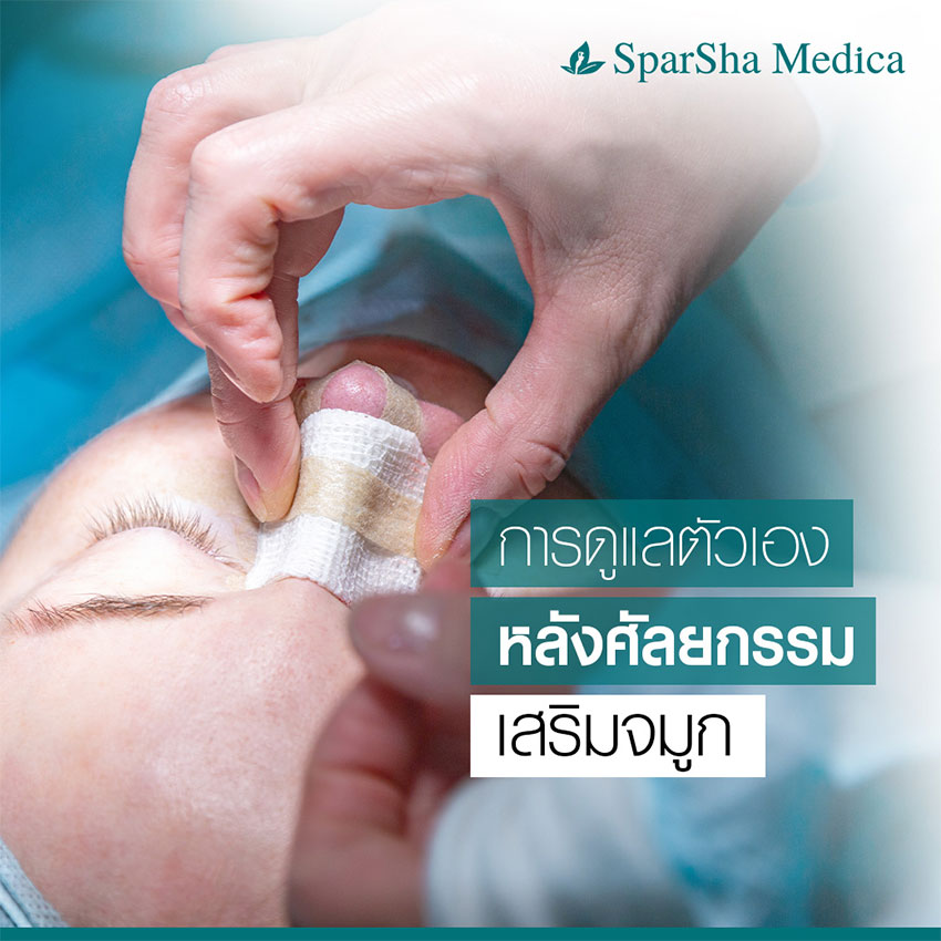เสริมจมูก ศัลยกรรมเสริมจมูก