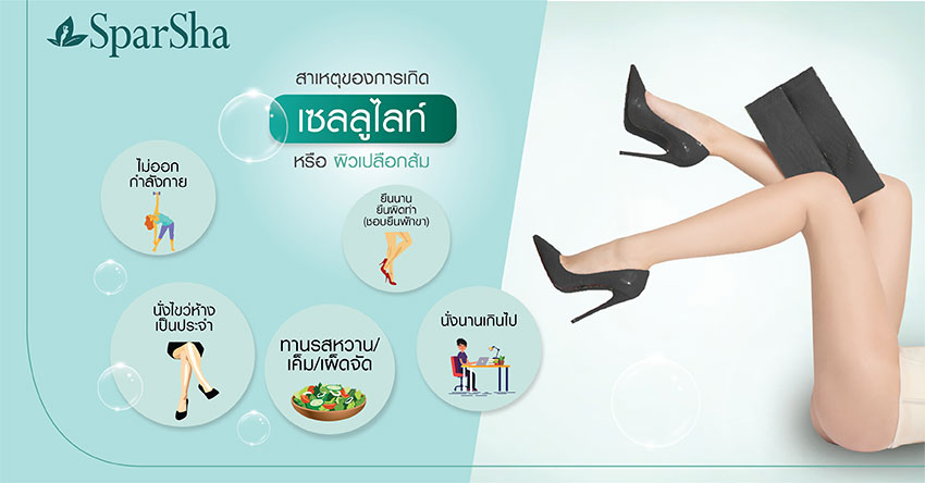 Leg Squeezing ลดเซลลูไลท์ ปัญหาผิวเปลือกส้ม