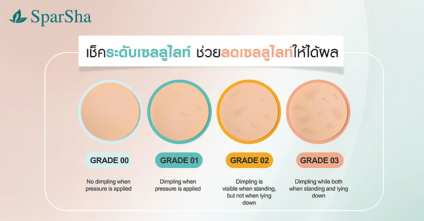 ลดเซลลูไลท์ ผิวเปลือกส้ม Anti Cellulite & Slim Program