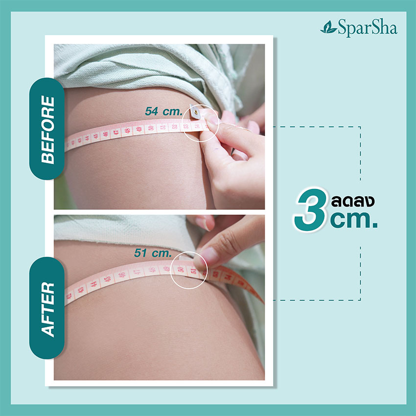 แก้ปัญหาสะโพกเผละ Hip Shape (คุณบิว ณัฏฐา ทองแก้ว)