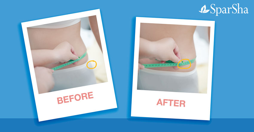 Freeze Shaping สลายไขมันด้วยความเย็น