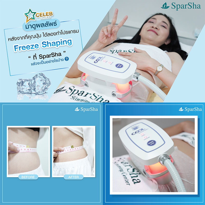 Freeze Shaping (คุณปุ้ม เปรมสุดา)