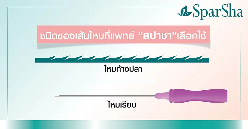 ยกกระชับ ร้อยไหม Thread Lift