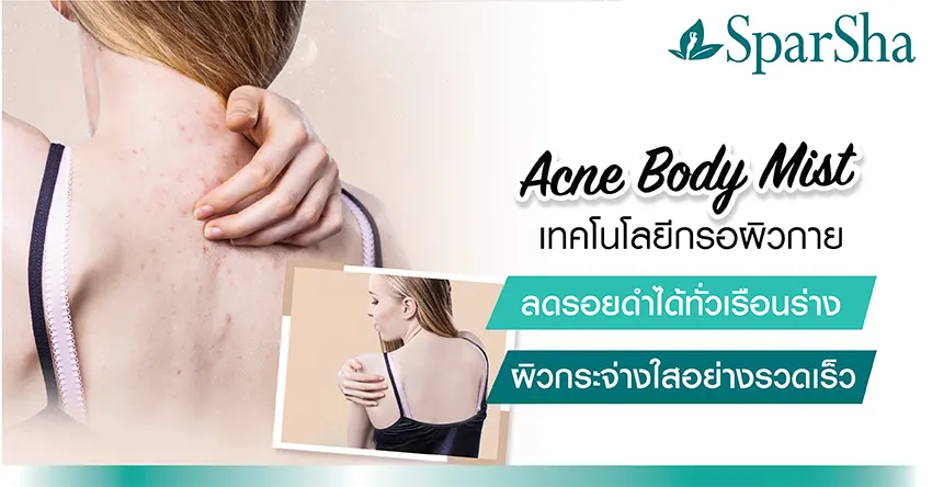 Acne Body Mist ลดรอยสิว ลดจุดด่างดำ ลดรอยดำ