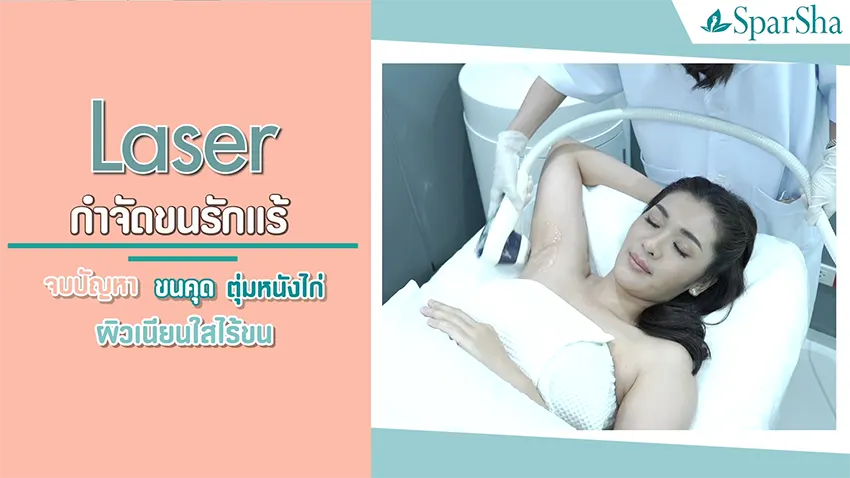 Permanent Hair Removal Laser กำจัดขนถาวร