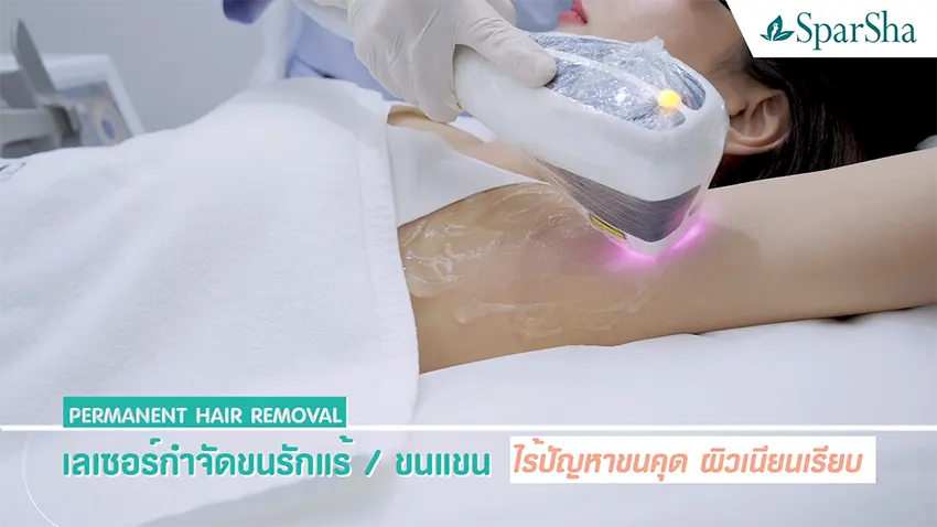 Permanent Hair Removal Laser กำจัดขนถาวร
