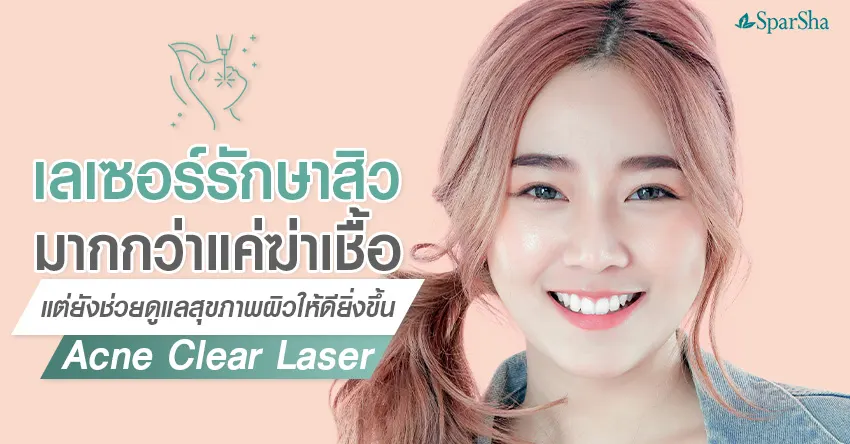 ฆ่าเชื้อสิว , Acne Clear Laser , ปัญหาสิว , เลเซอร์รักษาสิว