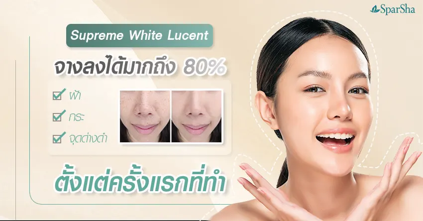 รักษาฝ้า กระ จุดด่างดำให้จางลงด้วยเลเซอร์ Supreme White Lucent
