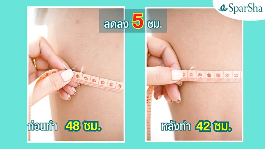 Beauty Shape สลายไขมันแบบเร่งด่วน ลดไขมัน