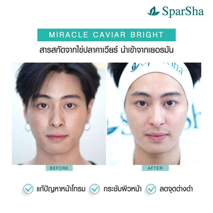 Miracle Caviar Bright