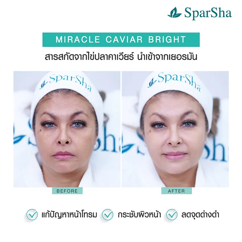Miracle Caviar Bright