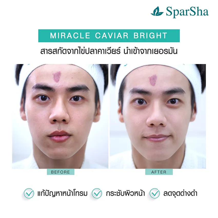 Miracle Caviar Bright