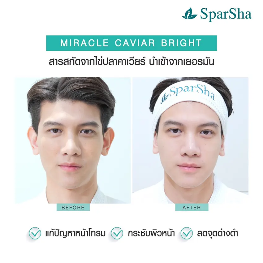 Miracle Caviar Bright