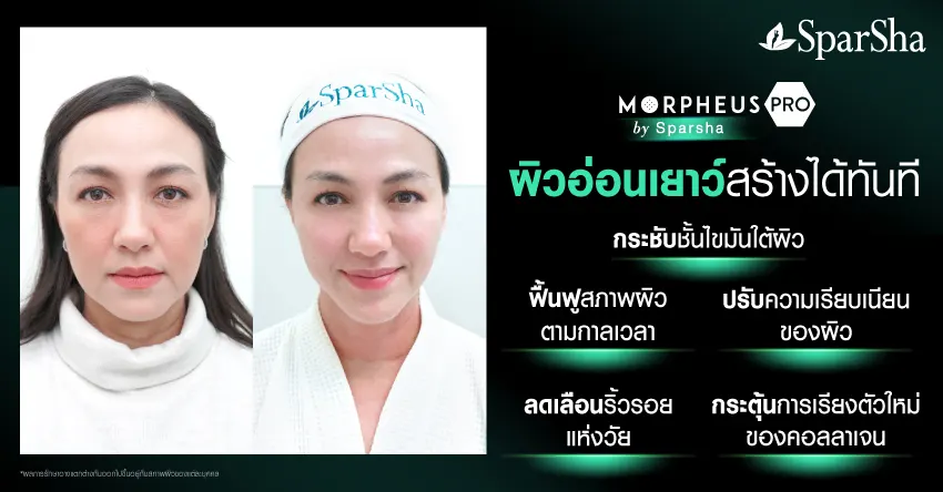 Morpheus Pro ยกกระชับ