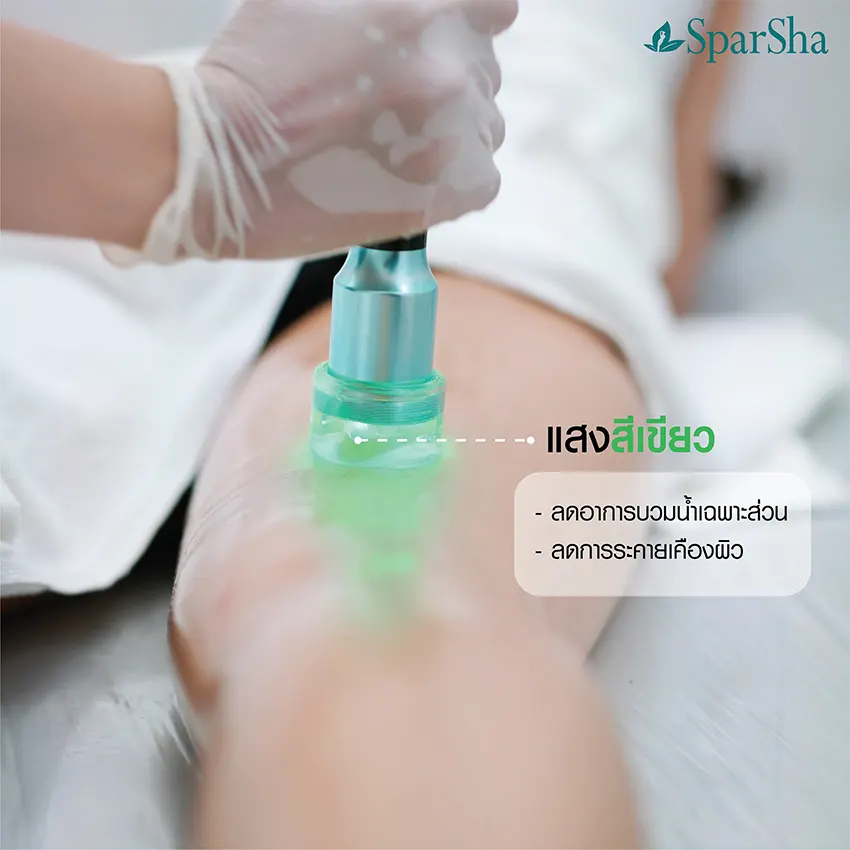 Leg Squeezing ลดเซลลูไลท์ ปัญหาผิวเปลือกส้ม