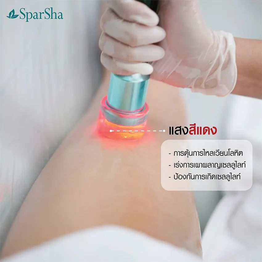 Leg Squeezing ลดเซลลูไลท์ ปัญหาผิวเปลือกส้ม
