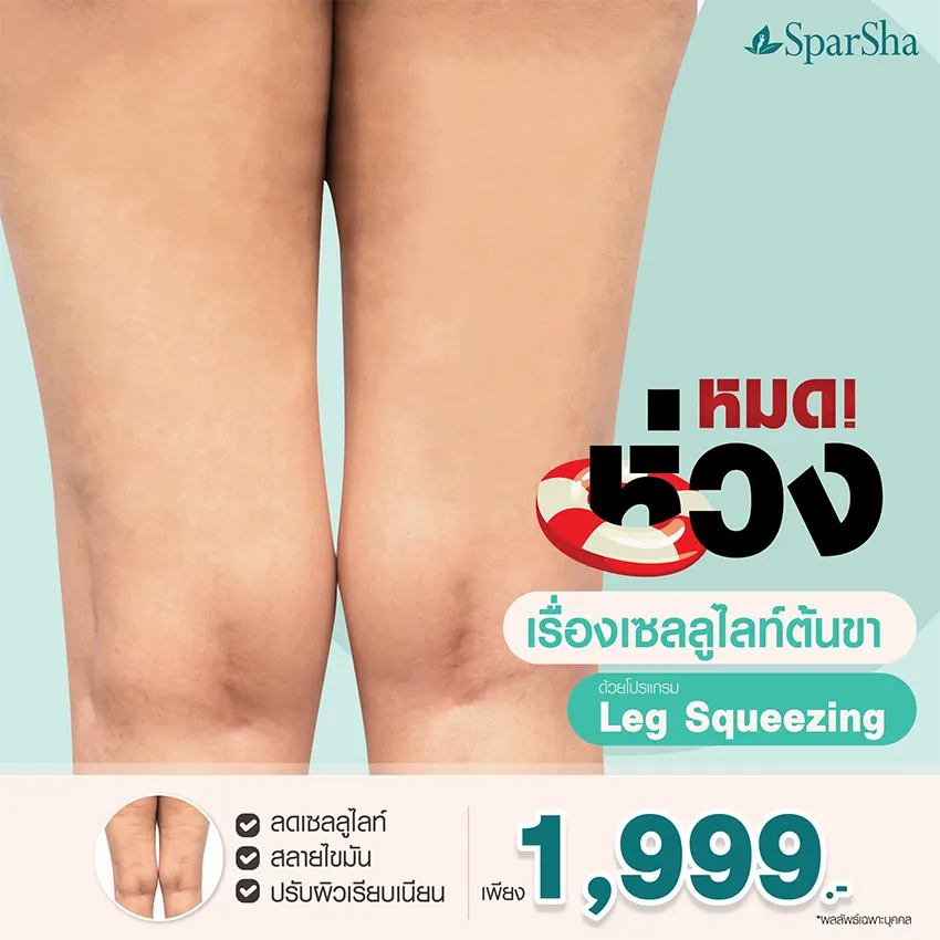 Leg Squeezing ลดเซลลูไลท์ ปัญหาผิวเปลือกส้ม