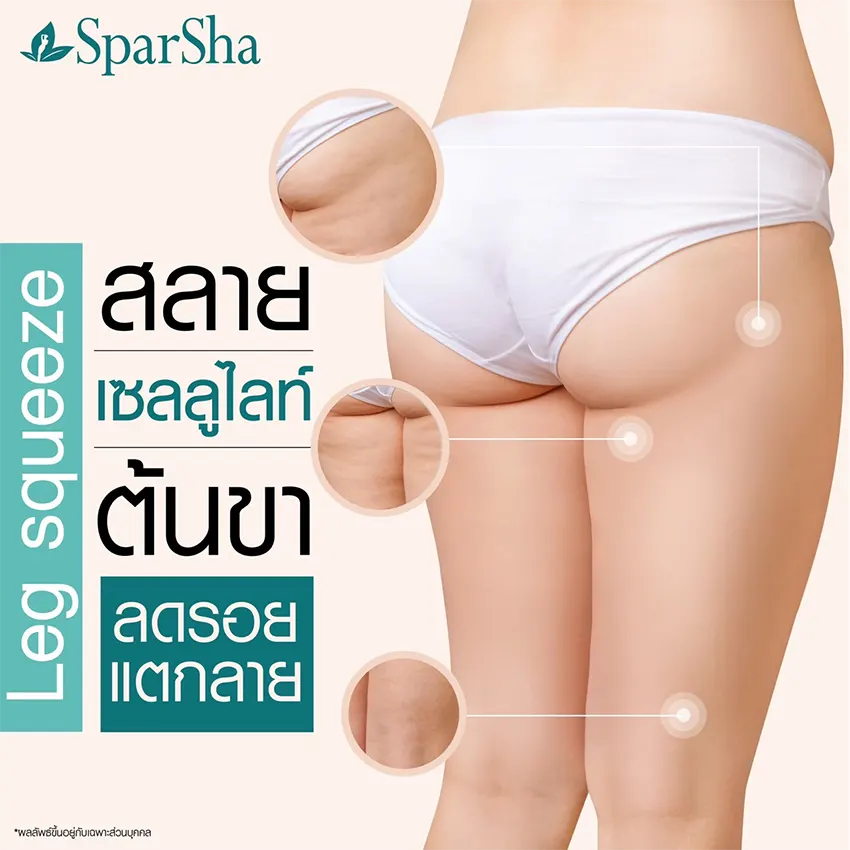 Leg Squeezing ลดเซลลูไลท์ ปัญหาผิวเปลือกส้ม