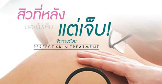 อีกหนึ่งโปรแกรมที่ลูกค้าไว้วางใจ Perfect Skin Treatment (PST)