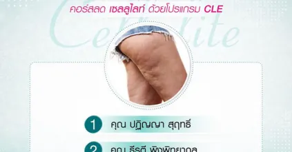 ประกาศรายชื่อผู้โชคดี กิจกรรมแจกคอร์สลดเซลลูไลท์ด้วยโปรแกรม CLE