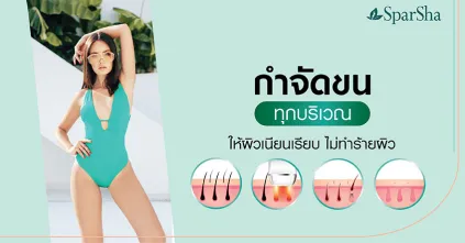 เลเซอร์กำจัดขนถาวร Permanent Hair Removal Laser
