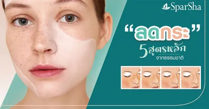 ลดกระ 5 สูตรหลักจากธรรมชาติ