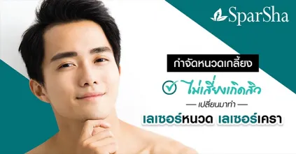 เลเซอร์หนวดเลเซอร์เครากำจัดขนถาวร (Permanent Hair Removal Laser)
