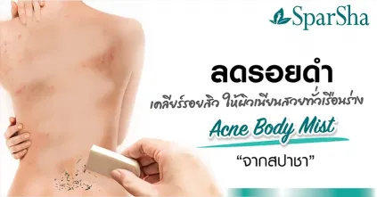 ลดรอยสิว รอยดำจุดด่างดำทั่วเรือนร่าง Acne Body Mist