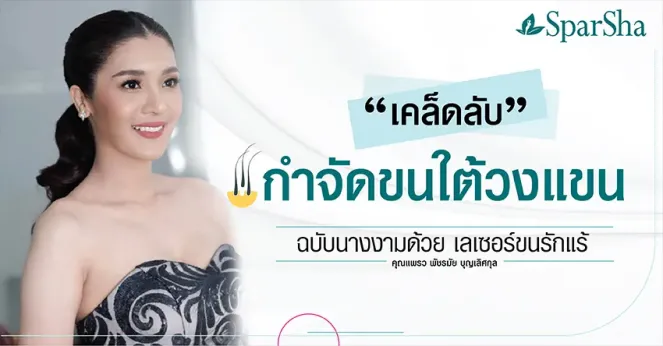 เคล็ดลับกำจัดขนใต้วงแขนด้วยเลเซอร์ขนรักแร้ (คุณแพรว พัชรมัย บุญเลิศกุล)