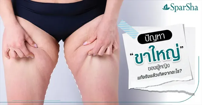 ปัญหาขาใหญ่ของผู้หญิงแท้จริงแล้วเกิดจากอะไร