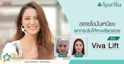 สลายไขมันเหนียงยกกระชับให้คางเรียวสวยด้วย Viva Lift (คุณนิ้ง ณิรินทร์ญา นักแสดงช่อง 3)